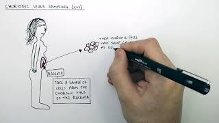 Embryo Screening - PGD, CVS & Amniocentesis | GCSE Biology (9-1) | kayscience.com