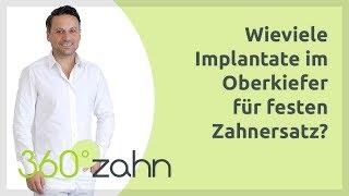 Wie viele Implantate im Oberkiefer für festen Zahnersatz? | Implantate | Fragen & Antworten 360°zahn