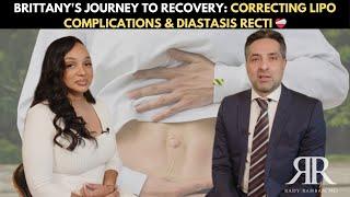 Brittany's Journey to Recovery️‍🩹: Correcting BOTCHED Liposuction & Diastasis Recti #plasticsurgery