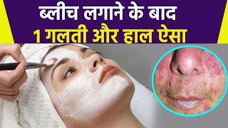 क्या आप भी Face पर Bleach लगाने के बाद करते ये Mistakes, पड़ सकता है भारी | Boldsky