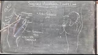 FEMORAL NERVE, ARTERY AND SAPHENO - FEMORAL JUNCTION