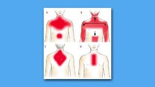 Herzinfarkt-Symptome - Diese Warnzeichen sollte jeder kennen