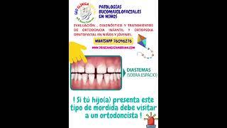 #DIASTEMAS DENTALES EN DENTICIÓN PERMANENTE Dra Bianca Zambrana Santa Cruz Bolivia