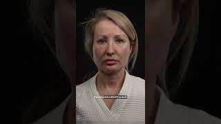 Омоложение лица