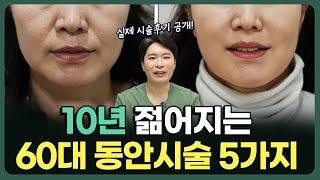 [1편] 60대 필수시술 5가지ㅣ또래보다 10년은 젊어집니다 (#피부과전문의)