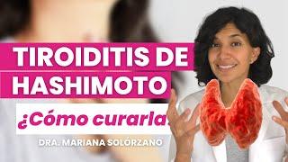 Tiroiditis de Hashimoto: como curar o revertir el hipotiroidismo con alimentación y suplementos