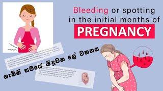 VAGINAL BLEEDING | EMERGANCY ROOM VISIT | 1st TRIMESTER UPDATE in SINHALA | Dhananjie Padmaperuma