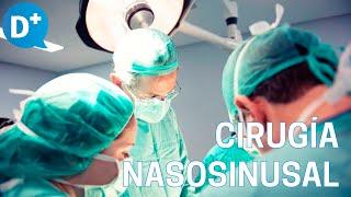 ¿Qué es la Cirugía endoscópica nasosinusal?