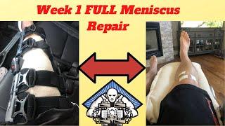 Week 1 after Full Meniscus Repair 
