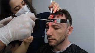 Sansone Capelli Hair Transplant Solutions [4K]