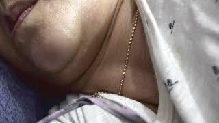 aunty Visible Neck Pulse While Sleeping #heartbeat #asmr