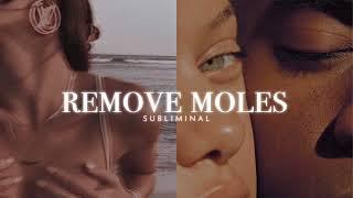 Remove Moles (+ More) || Subliminal