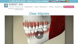 Clear Aligners London - Forest & Ray - Dentists, Orthodontists, Implant Surgeons