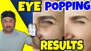 Make Your Eye Skin Look YOUNGER Fast With 2 Steps!
