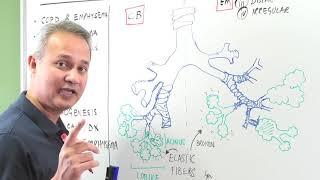 Comparison of Emphysema with Chronic Bronchitis