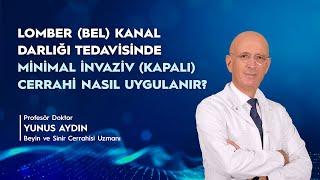 Lomber (Bel) Kanal Darlığı Tedavisinde Minimal İnvaziv Kapalı Cerrahi Nasıl Uygulanır?