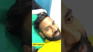 Hair PRP Treatment Video | PRP for Hair Loss | Hair PRP(Platelet-rich plasma) Cost | Dr. Pranil More