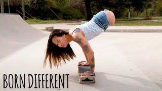 Born Without Legs - But I Can Still Do Anything | BORN DIFFERENT