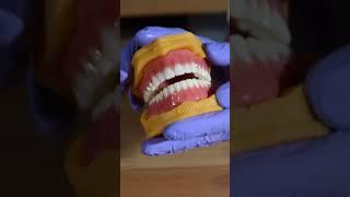 Denture 3D printing Evident #digitaldentist #dentist #dentistry #dentaltechnology #dental