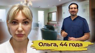 Омоложение лица: Ольга , 44 года.