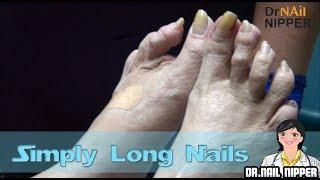 Simply Long Nails.  Does he have long toenails problems?