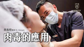 【微整形美學】肉毒的應用｜Dr.Keegan #顏義標醫師｜金貞醫學美容