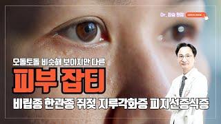 오돌토돌 비슷해 보이지만 다른 피부 #잡티  #닥터최승 #비립종 #한관종 #쥐젖 #지루각화증 #피지선증식증