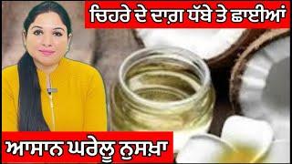 Coconut Oil For Skin | Home Remedy For Dry Skin, Pimples, Wrinkles, Blemishes | Health Advice