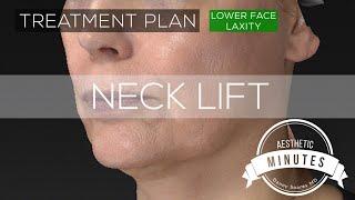 48 yo Female Neck Lift - Turning Back the Clock | Aesthetic Minutes #Necklift