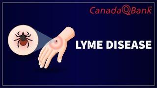 Lyme Disease