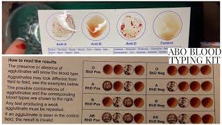 BLOOD TYPING WITH THE ELDON CARD | ️️️