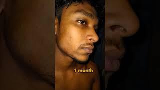 minoxidil 3 months beard journey amazing results #minoxidil #beardgrowthoil #beard #short