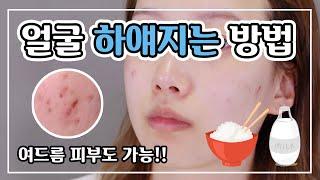 SUB) 여드름 피부도 가능한 피부 미백  집에서 얼굴 하얘지는 라이스 밀크팩 하는법 ⎮ 미소정 MisoJeong