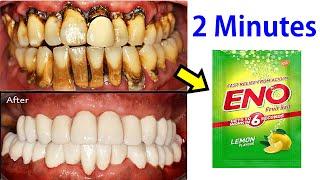 Apply Eno and Make Instant White Teeth In 2 minutes - Teeth Whitening Treatment