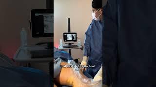 Lipedema Reduction Surgery on patient's Calves with Dr. Wright   #lipedema