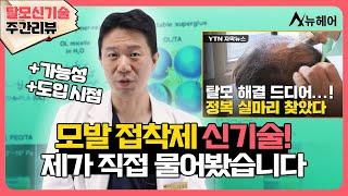 [#탈모신기술 주간리뷰] 모발 접착제 신기술, 제가 교수님께 직접 물어봤습니다
