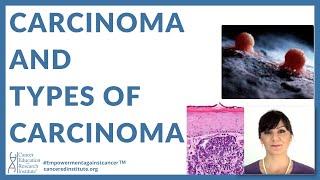 #11 | What is CARCINOMA? | Cancer Education and Research Institute