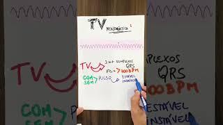 Taquicardia Ventricular Monomórfica #enfermagem #enfermagemprotagonista #eletrocardiograma #ecg