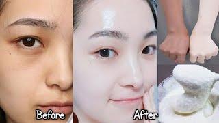 Japanese Secret To Whitening 10 Shades That Removes Wrinkles And Pigmentation For Fair Skin