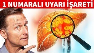 Yağlı Bir Karaciğeriniz Olduğuna Dair 1 Numaralı Uyarı İşareti | Dr.Berg Türkçe