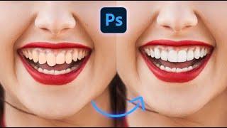 Perfect Smile - Short Photoshop Tutorial