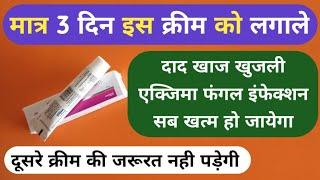 मात्र 1 क्रीम से दाद खाज खुजली 3 दिन में खत्म Best Ketoconazole Cream For Fungal Infection Problems