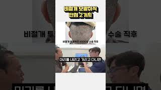 비절개 모발이식 단점 2가지