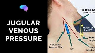 Measuring Jugular Venous Pressure (JVP) - OSCE Guide (Clip) | UKMLA | CPSA