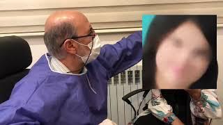 عملية تجميل الانف مع دكتور امير عباس لطفعلي زادة / جراحة تجميل الانف في ايران مشهد 00989398297154