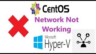 How to fix centos network not connected in hyper-v | No network issue in Hyper-v