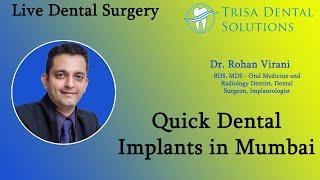 Full mouth Dental Implants in Mumbai | Dental implants in 8 minutes | Live Surgery of Dental Implant