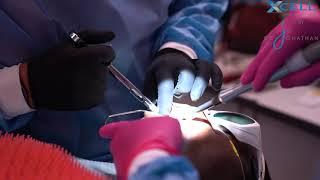 Xcell Dental Implants: Surgery Recap