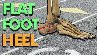 Landing on your Heel will make your Flat Feet worse (How to Walk)