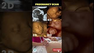 See your Baby face  in pregnancy | 2D/ 3D/ 4D & HD baby Scan  Pregnancy scan reports #shortsvideo